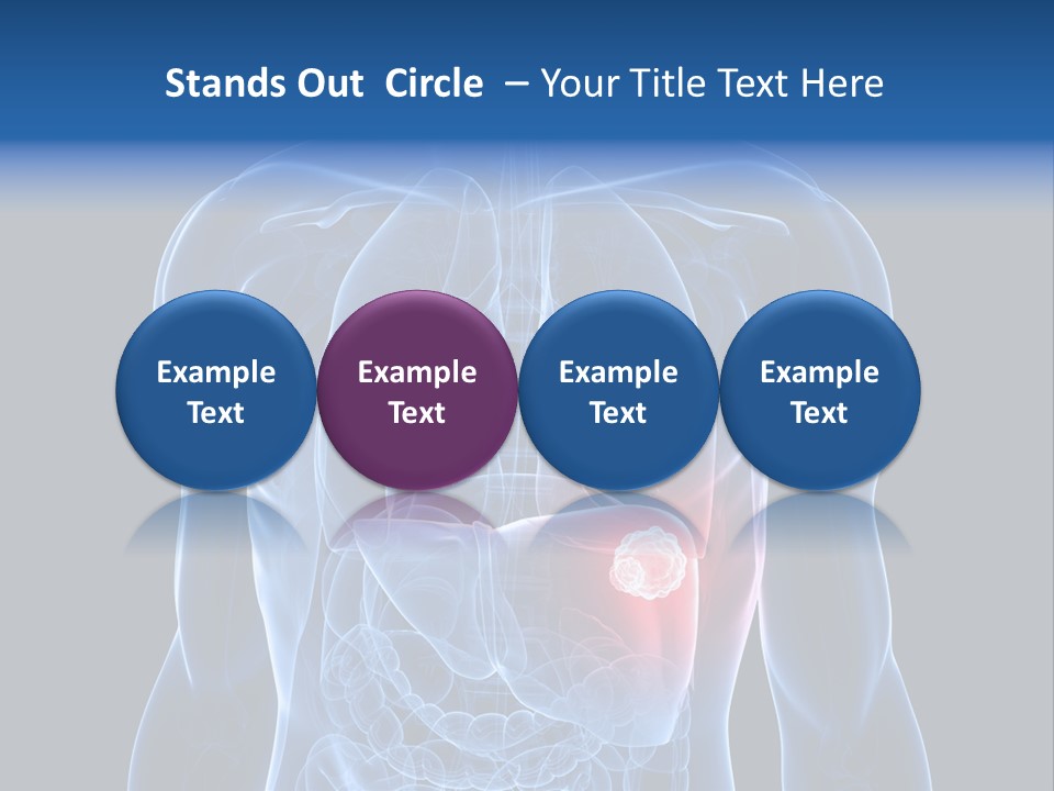 Tumor Cancer Medical PowerPoint Template