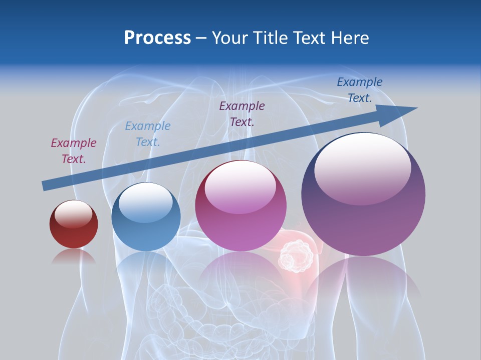 Tumor Cancer Medical PowerPoint Template
