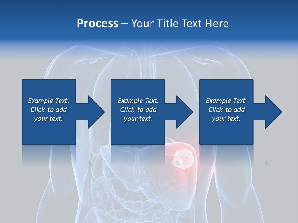 Tumor Cancer Medical PowerPoint Template