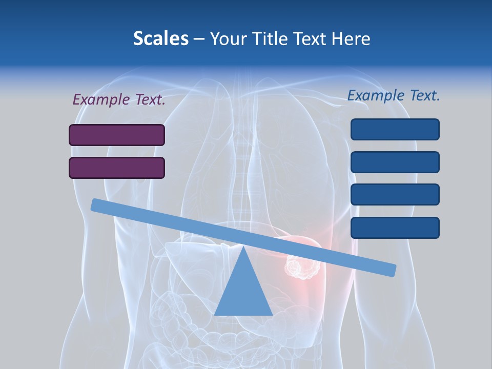 Tumor Cancer Medical PowerPoint Template