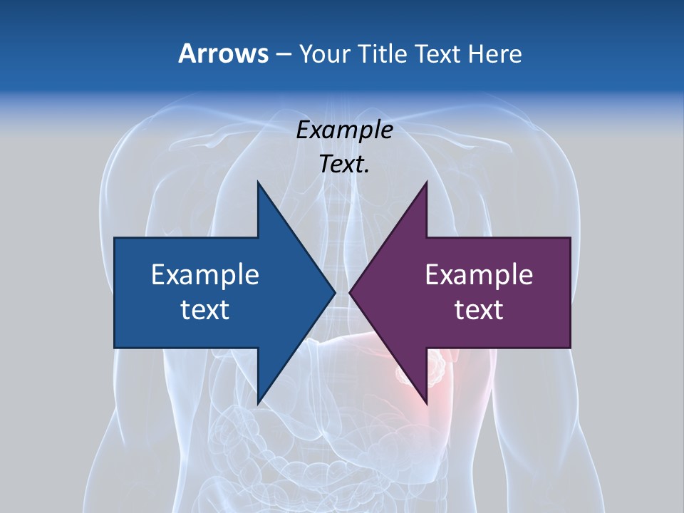 Tumor Cancer Medical PowerPoint Template