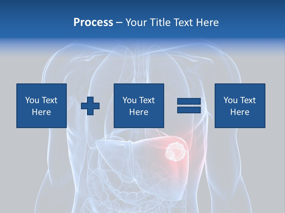 Tumor Cancer Medical PowerPoint Template
