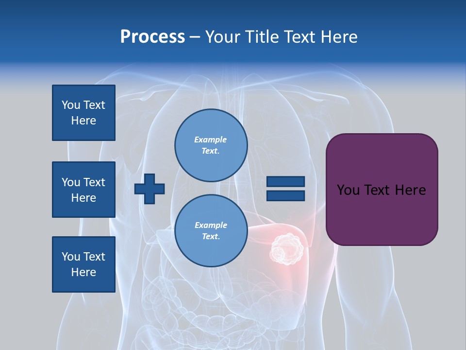 Tumor Cancer Medical PowerPoint Template