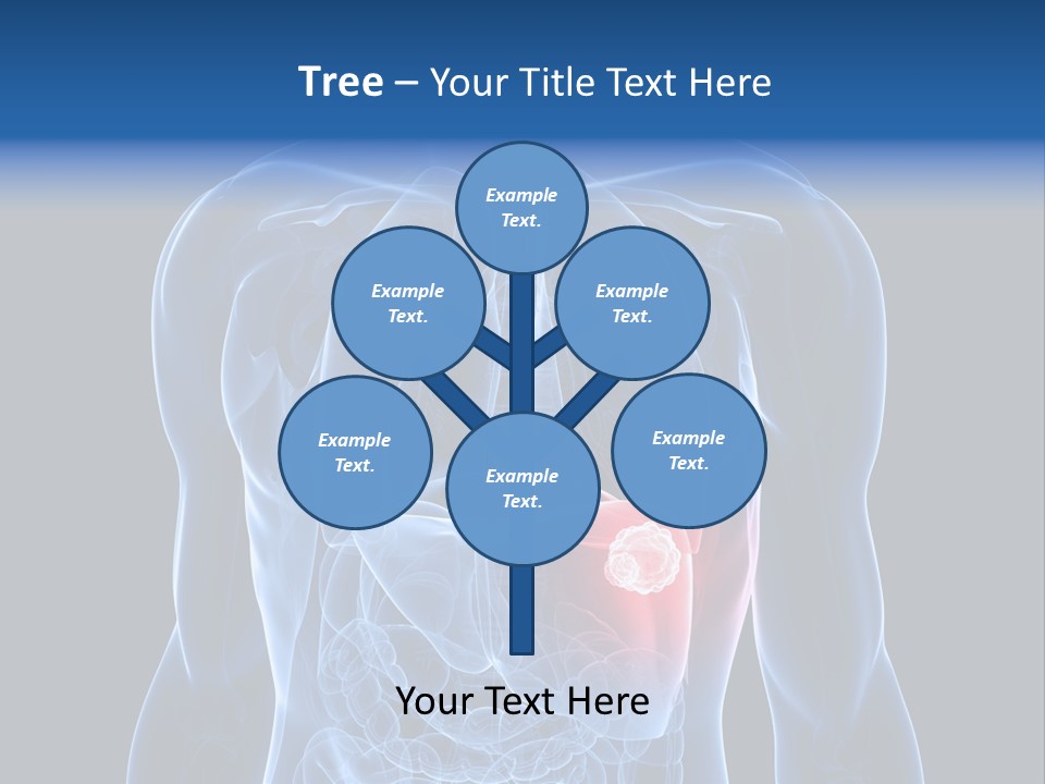 Tumor Cancer Medical PowerPoint Template
