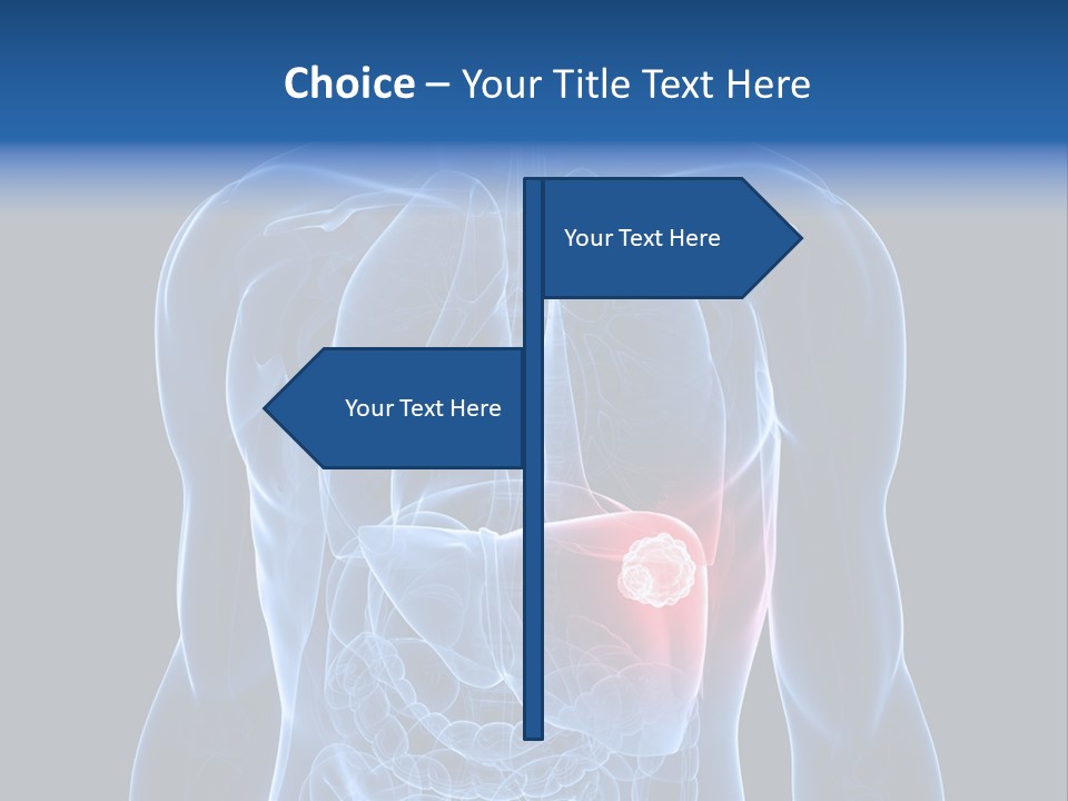 Tumor Cancer Medical PowerPoint Template