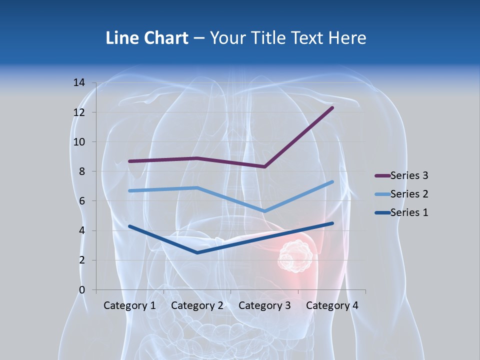 Tumor Cancer Medical PowerPoint Template
