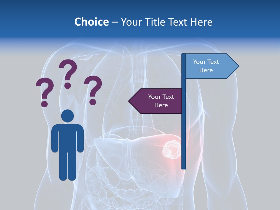 Tumor Cancer Medical PowerPoint Template