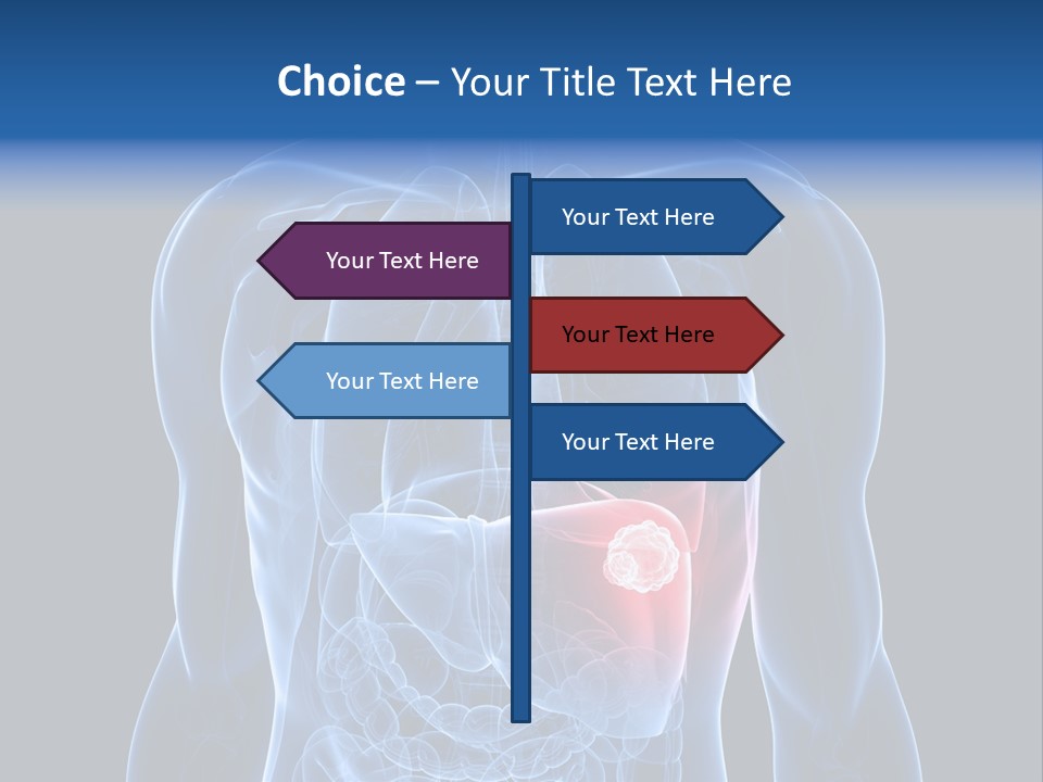 Tumor Cancer Medical PowerPoint Template