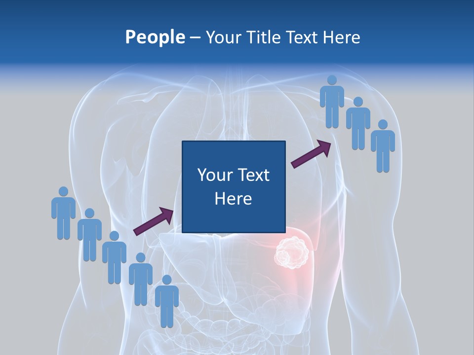 Tumor Cancer Medical PowerPoint Template