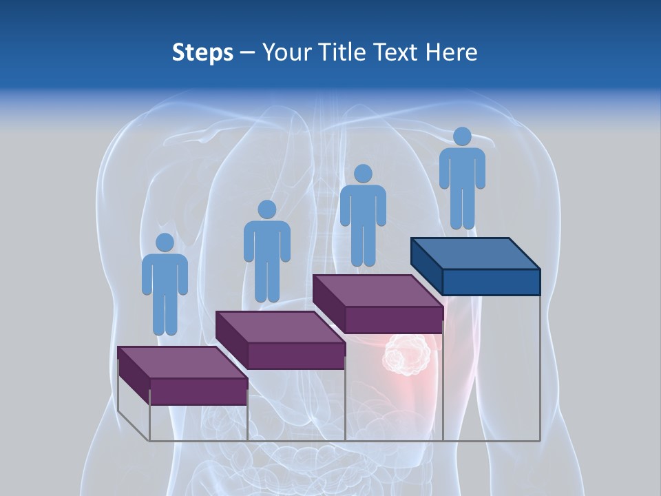 Tumor Cancer Medical PowerPoint Template