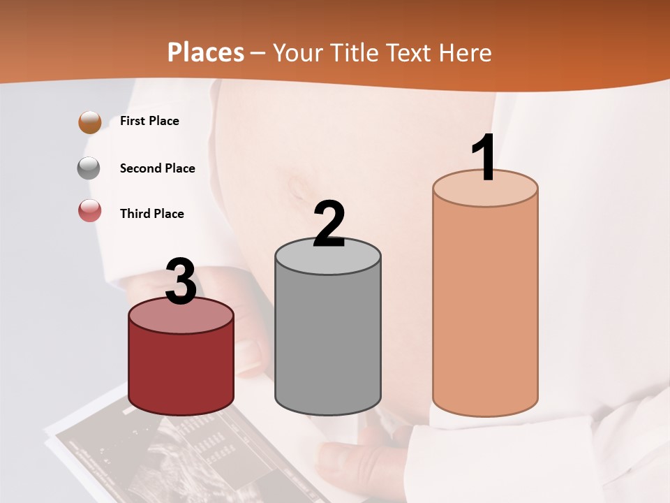 Beautiful Expectation Expect PowerPoint Template