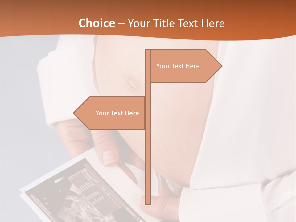 Beautiful Expectation Expect PowerPoint Template