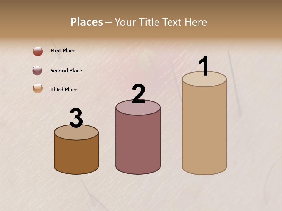 Excrescence Teenage Closeup PowerPoint Template