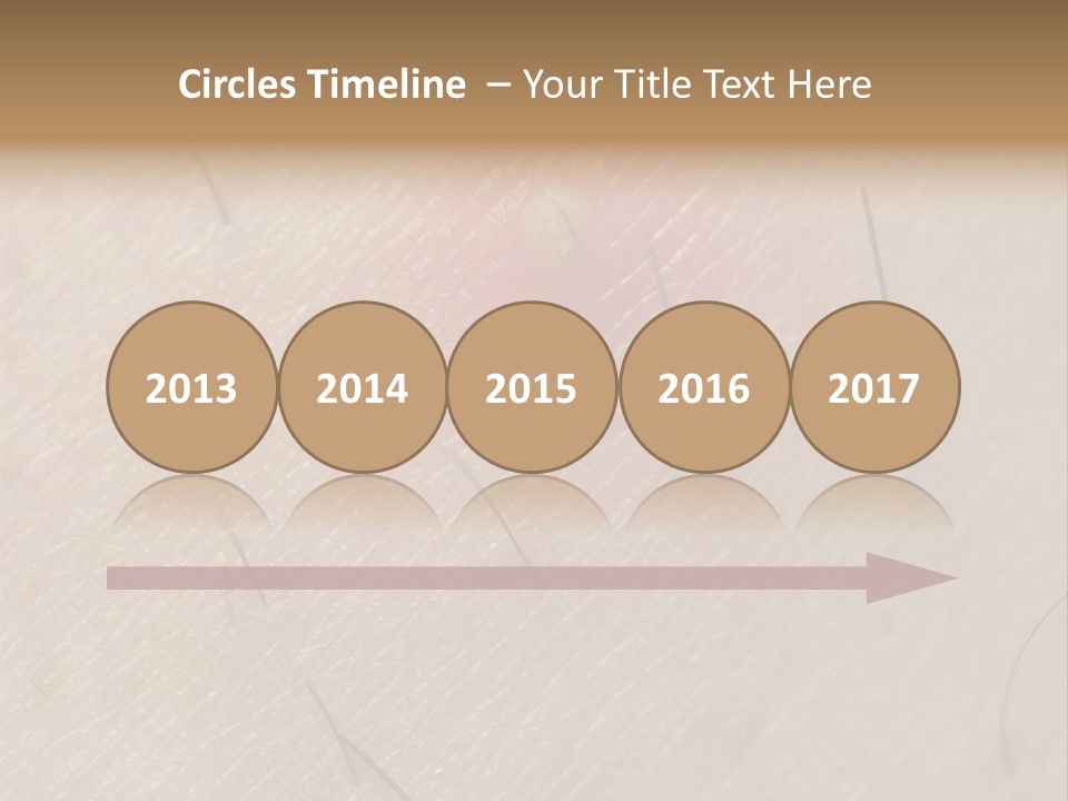 Excrescence Teenage Closeup PowerPoint Template