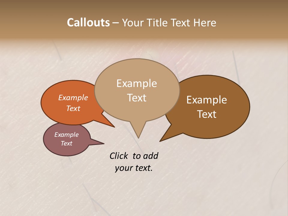 Excrescence Teenage Closeup PowerPoint Template
