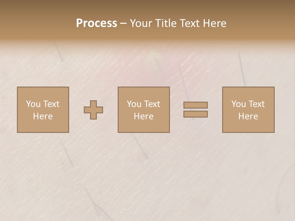 Excrescence Teenage Closeup PowerPoint Template