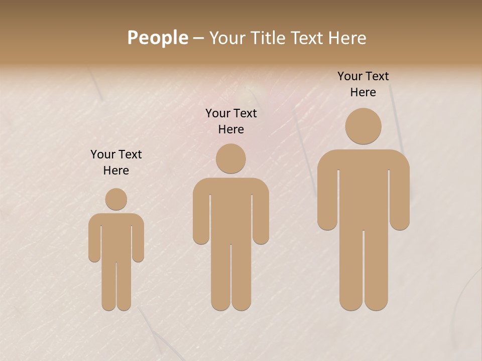 Excrescence Teenage Closeup PowerPoint Template