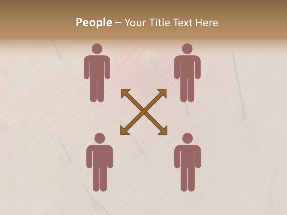 Excrescence Teenage Closeup PowerPoint Template