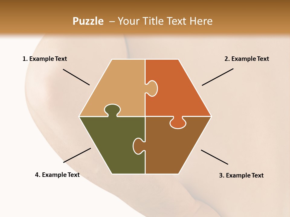 Ache Hand Injury PowerPoint Template