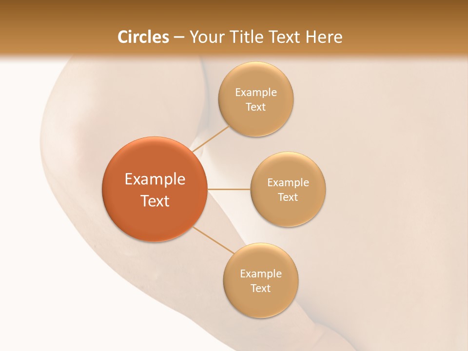 Ache Hand Injury PowerPoint Template