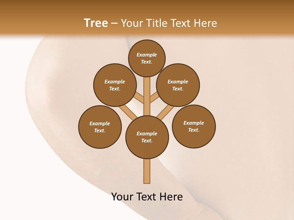 Ache Hand Injury PowerPoint Template