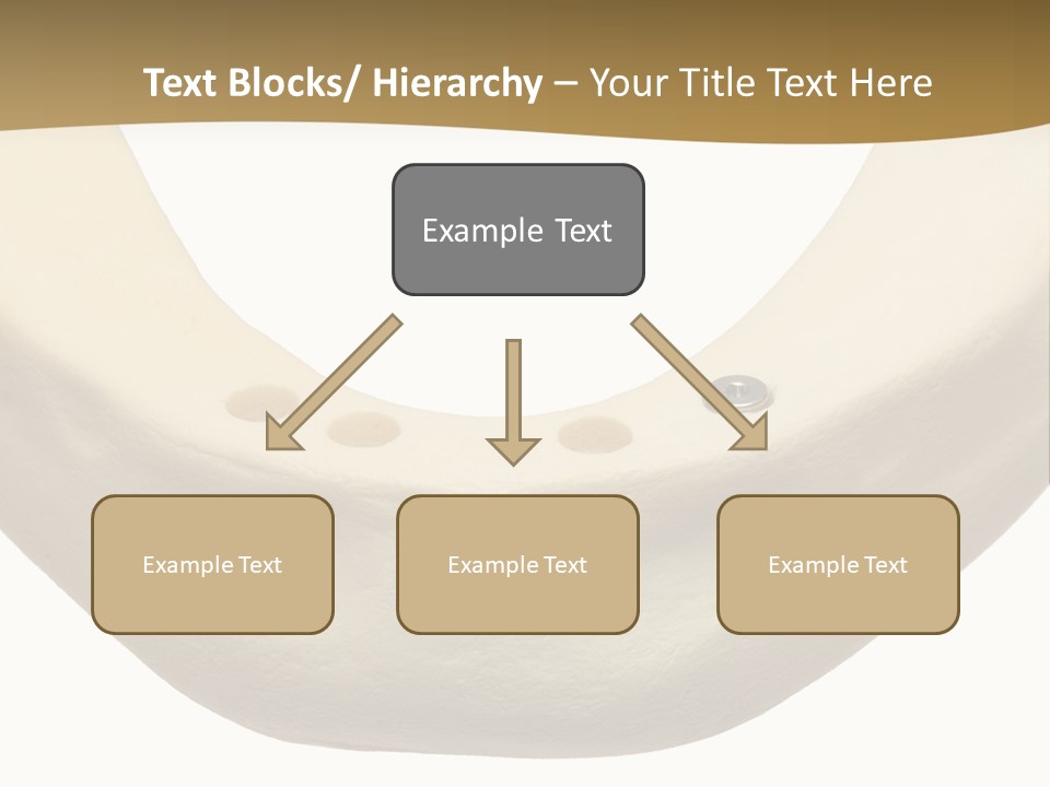 Pain Graft Medical PowerPoint Template