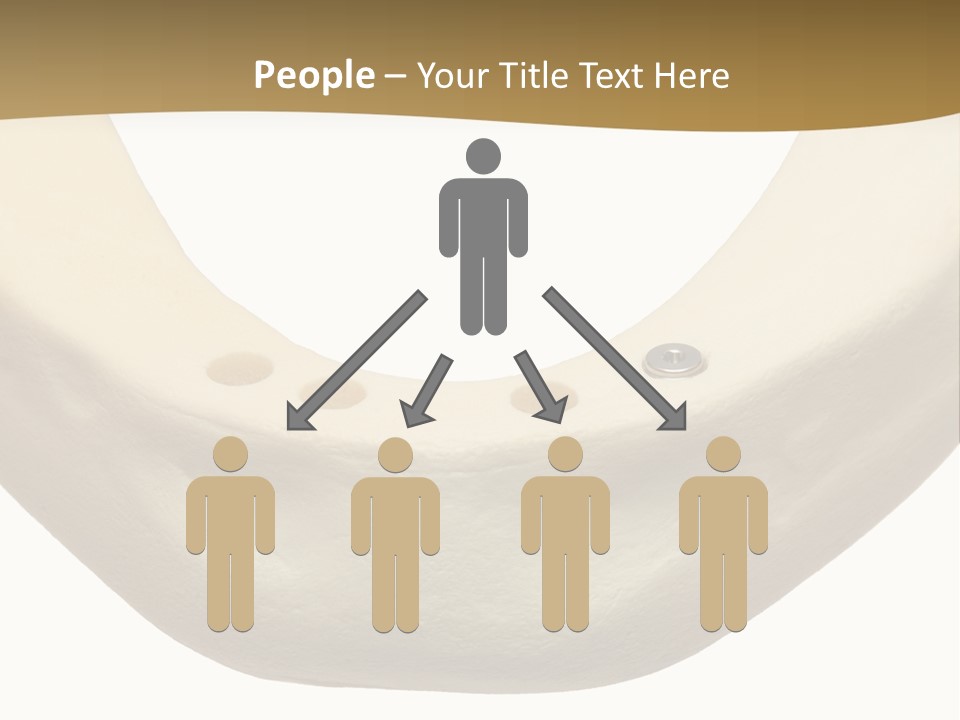 Pain Graft Medical PowerPoint Template