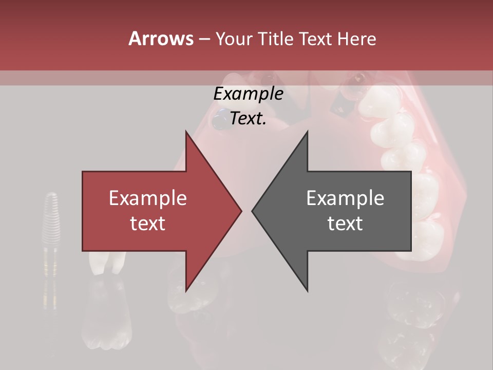 Pink Angled Orthodontist PowerPoint Template