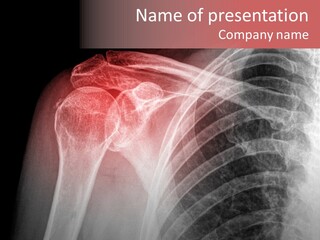 Injury Surgery Biology PowerPoint Template