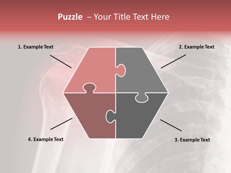 Injury Surgery Biology PowerPoint Template