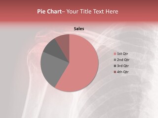 Injury Surgery Biology PowerPoint Template