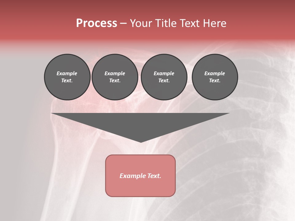 Injury Surgery Biology PowerPoint Template