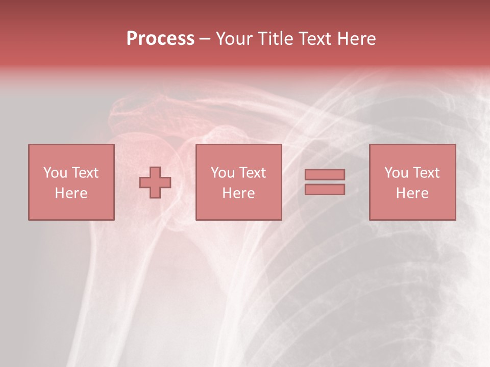 Injury Surgery Biology PowerPoint Template