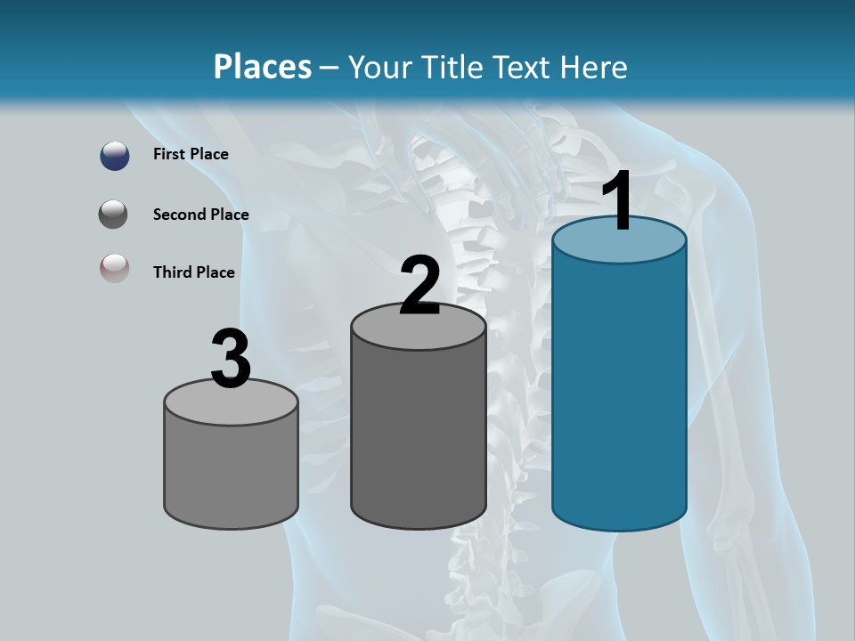 People Graphic Osteoporosis PowerPoint Template