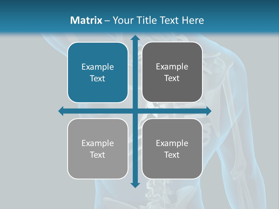 People Graphic Osteoporosis PowerPoint Template