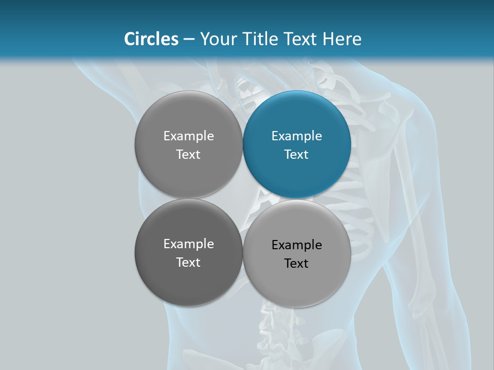 People Graphic Osteoporosis PowerPoint Template