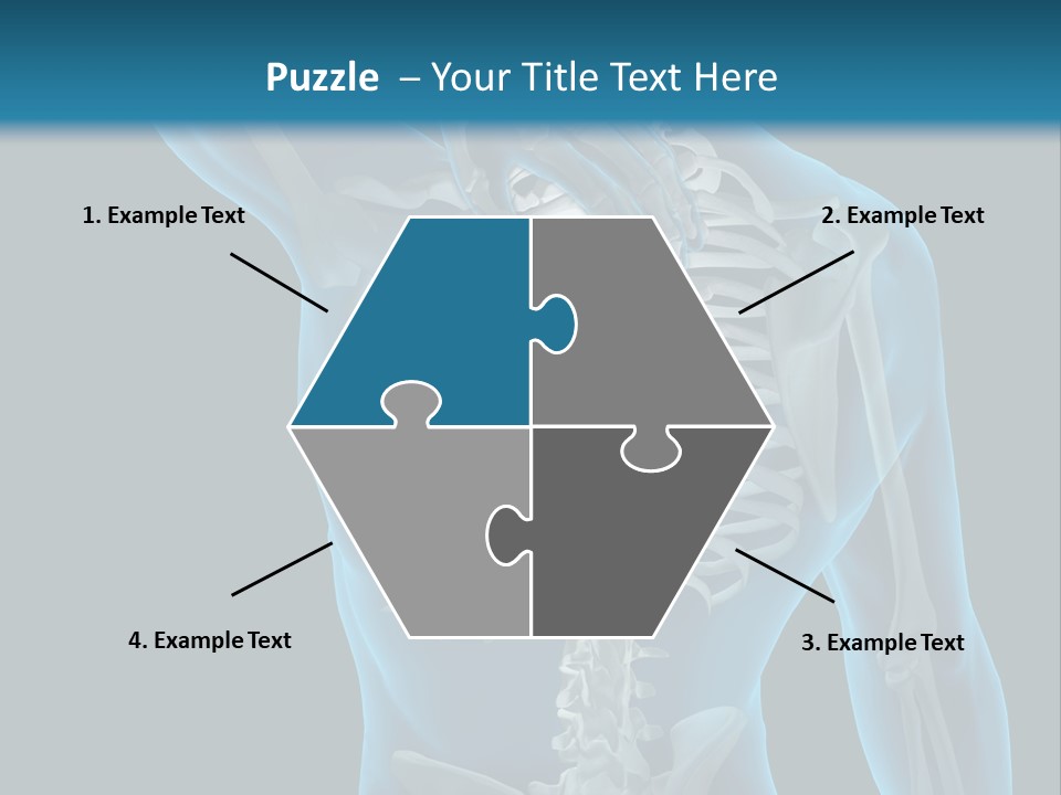 People Graphic Osteoporosis PowerPoint Template