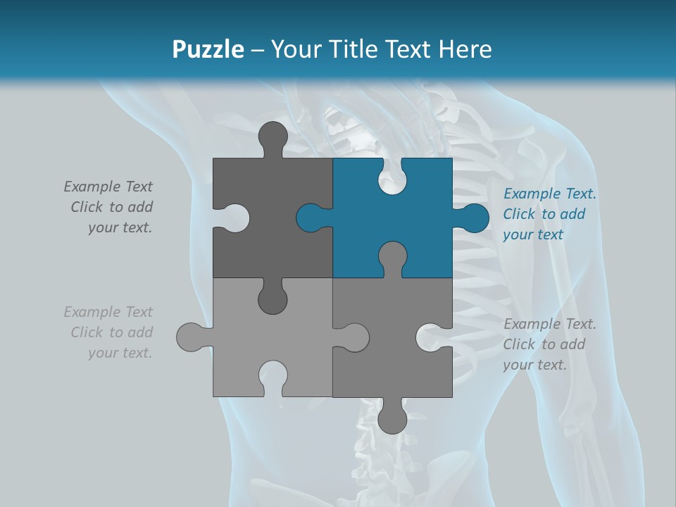 People Graphic Osteoporosis PowerPoint Template