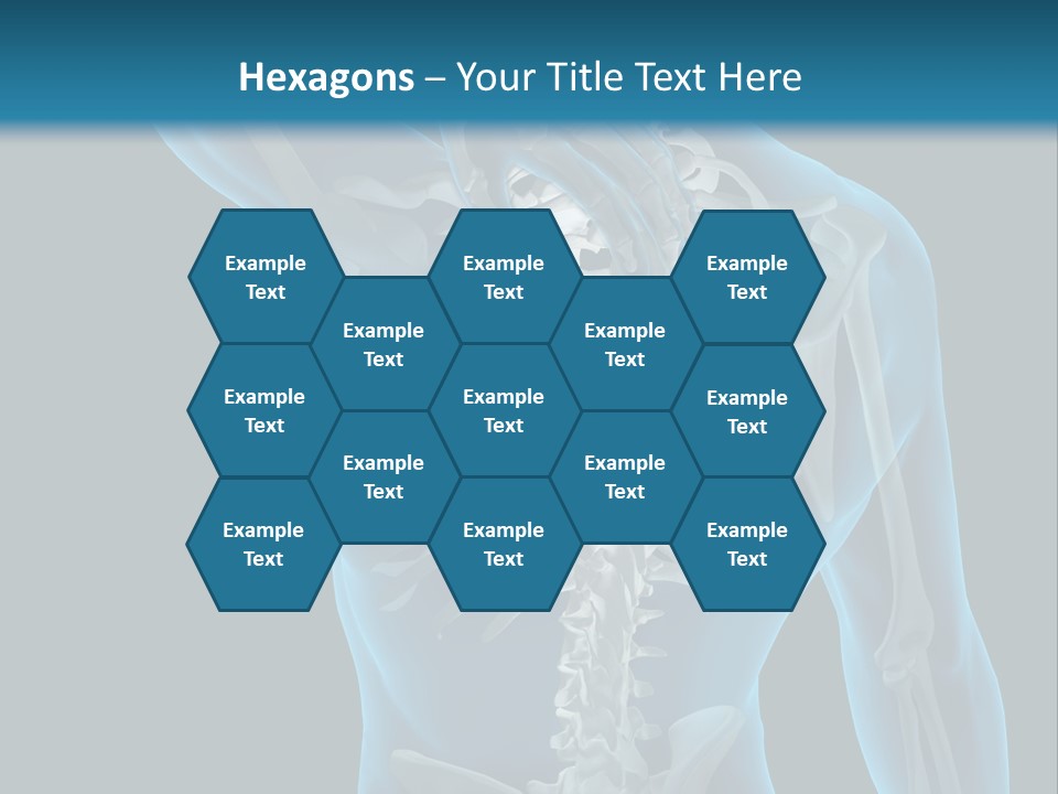 People Graphic Osteoporosis PowerPoint Template