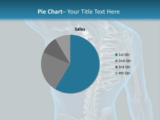 People Graphic Osteoporosis PowerPoint Template