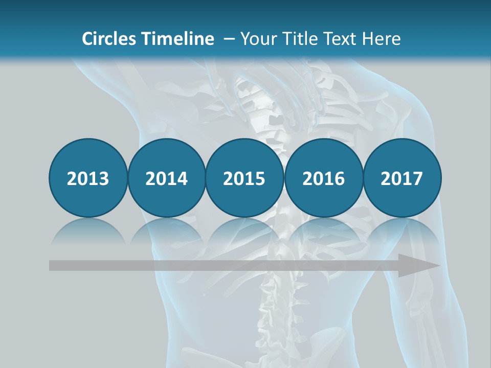 People Graphic Osteoporosis PowerPoint Template