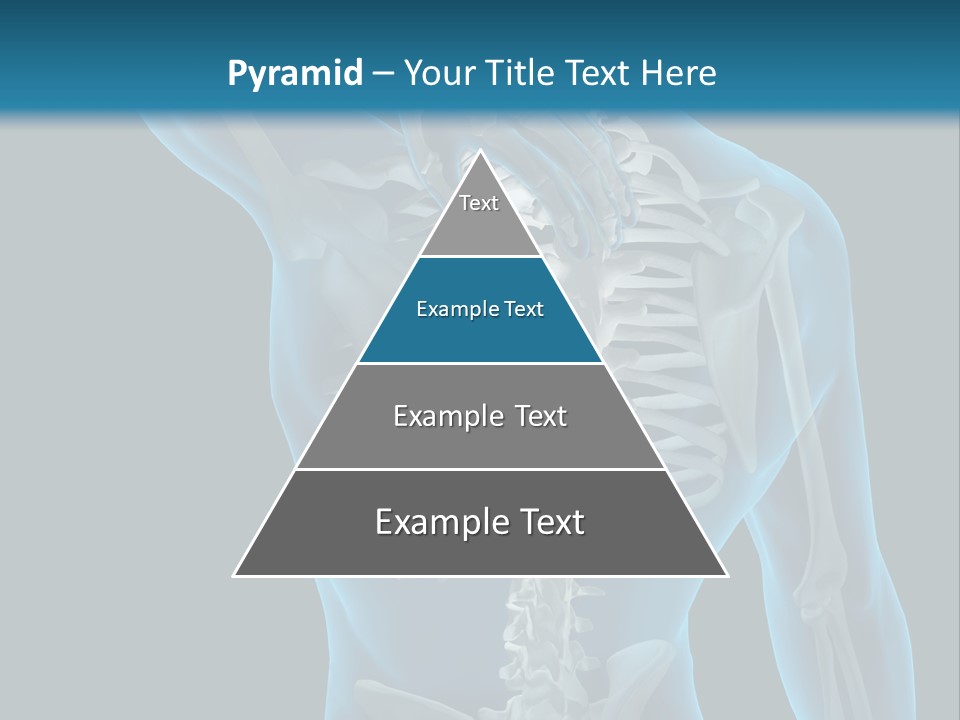 People Graphic Osteoporosis PowerPoint Template