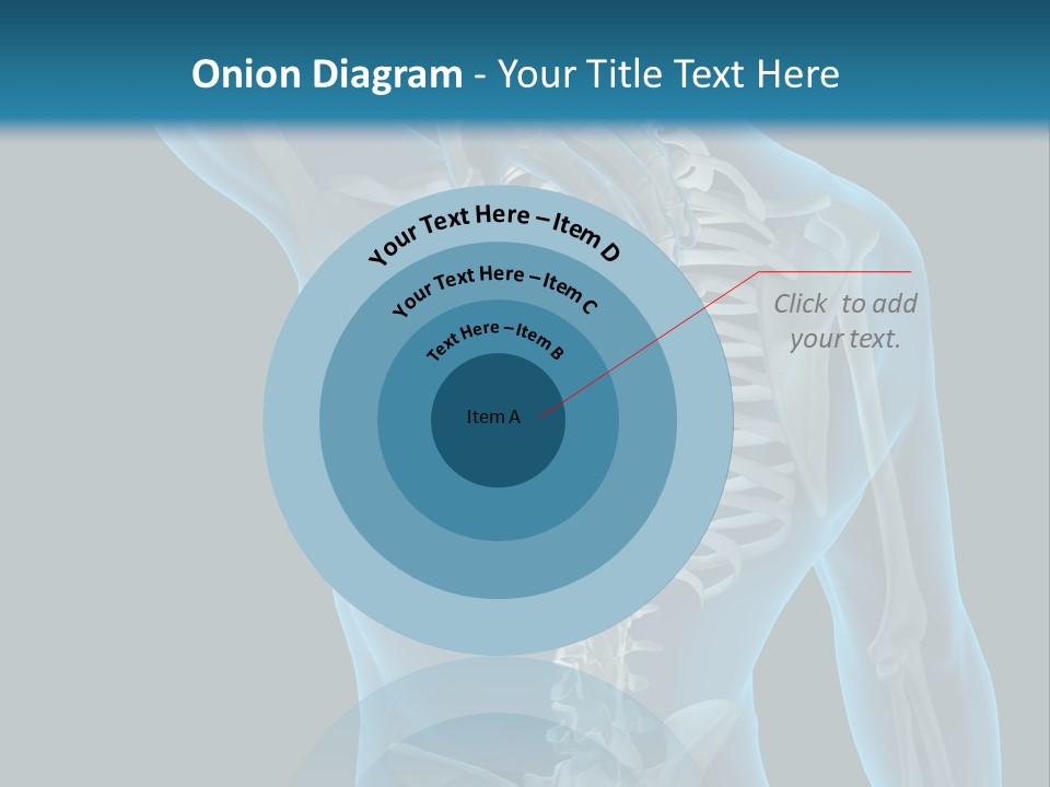 People Graphic Osteoporosis PowerPoint Template