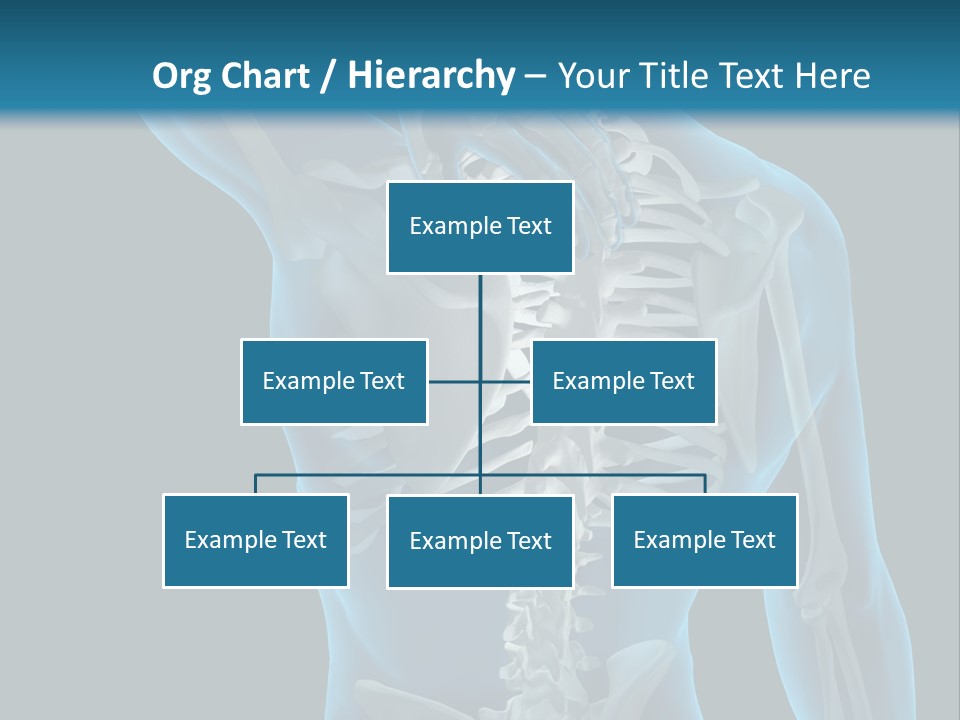 People Graphic Osteoporosis PowerPoint Template