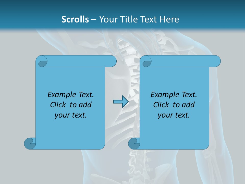 People Graphic Osteoporosis PowerPoint Template
