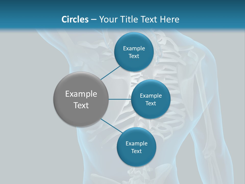 People Graphic Osteoporosis PowerPoint Template