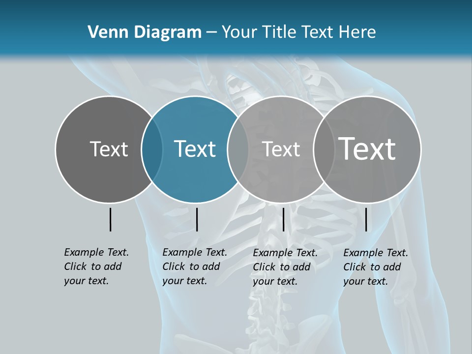People Graphic Osteoporosis PowerPoint Template