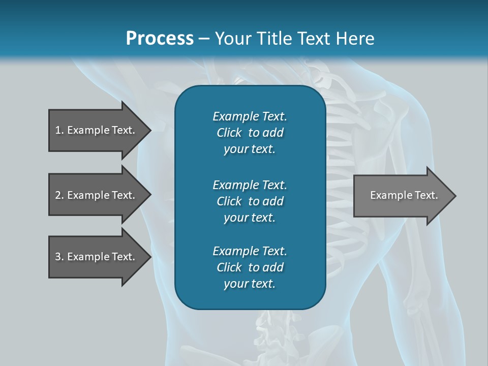 People Graphic Osteoporosis PowerPoint Template