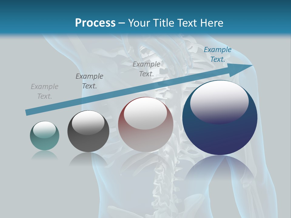 People Graphic Osteoporosis PowerPoint Template