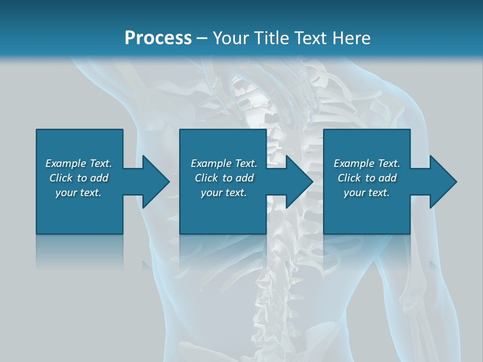 People Graphic Osteoporosis PowerPoint Template